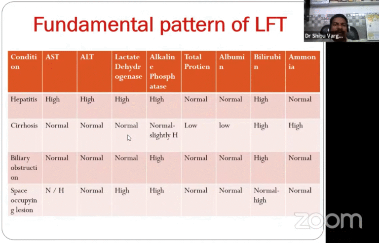 INVESTIGATION IN INFLAMMATORY ARTHRITIS – Dr. SHIBU VARGHESE